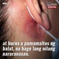 Previous COVID-19 infection can make you allergic to hair dye, experts warn | GMA News Feed