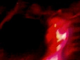 Circus MA Ally Nono Justine