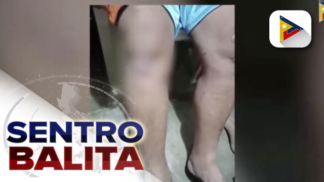MALASAKIT AT WORK: Isang residente ng Q.C., humihingi ng tulong para sa gamutan ng tatay na mayroong psoriasis arthritis