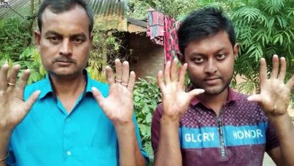 ১টি উটপাখির ডিমে থাকে ২০০০ ক্যালরি শক্তি যা ১টি মুরগির ডিমের ২৭ গুণ... আমরা খাইন