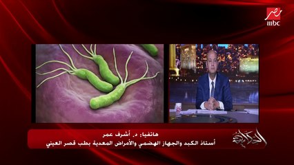 د. أشرف عمر أستاذ الكبد والجهاز الهضمي يشرح خطورة جرثومة المعدة: نص سكان العالم عندهم الجرثومة ومضاعفاتها تؤدي لسرطان المعدة أو الغدد الليمفاوية