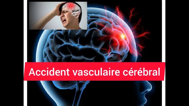 Lancement d'un nouveau projet pour accentuer la lutte contre l'hypertension arterielle