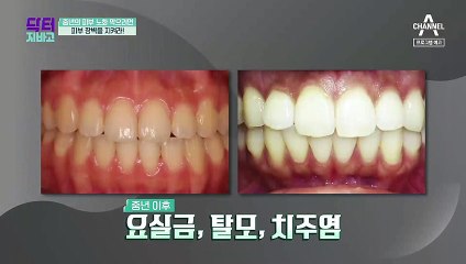 [예고] 요실금, 탈모, 피부노화의 원인이 되는 콜라겐 부족?! 피부 건강 지키고 동안 되는 법!