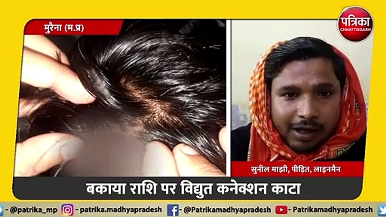 बकाया राशि पर विद्युत कनेक्शन काटा, नाराज युवक ने लाइनमैन का फोड़ा सिर