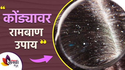 केसातील कोंडा घालवण्यासाठी रामबाण उपाय | How to Get Rid of Dandruff DIY Permanently | Lokmat Sakhi