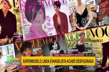 Desfigurada tras operaciones: Así quedó la ex súpermodelo Linda Evangelista