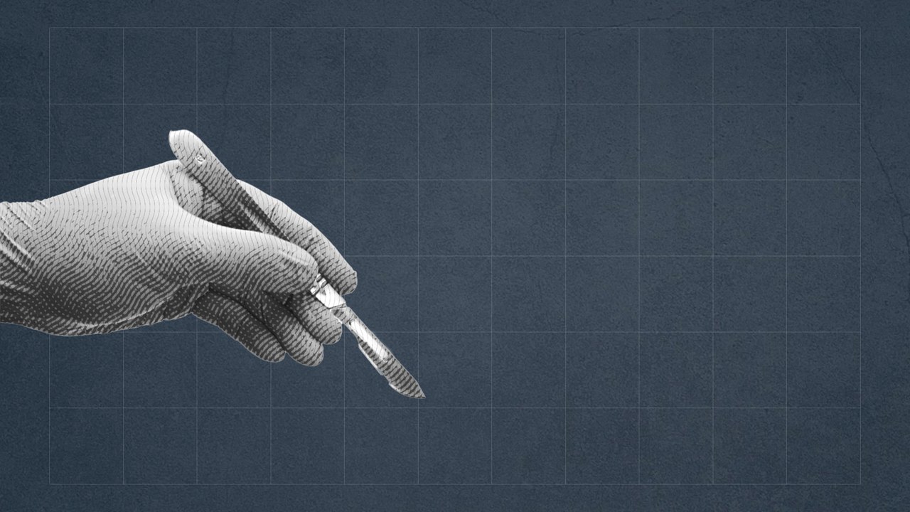 Schönheitstrends: So gefährlich ist der 'Brazilian Butt Lift'