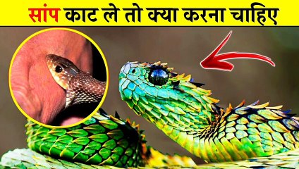 सांप काट ले तो क्या करना चाहिए ?  | What To Do If A Snake Bites 