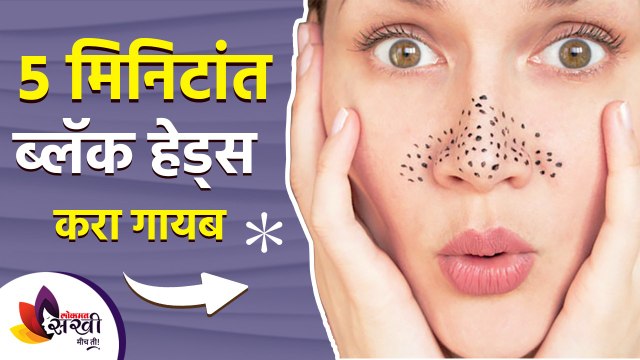 ५ मिनिटात ब्लॅक हेड्स करा गायब | Remove Blackheads in Just 5 Minutes | Lokmat Sakhi