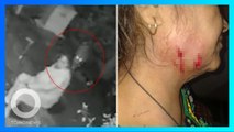 Diserang Macan Tutul, Wanita India Pukul Pakai Tongkat Jalan