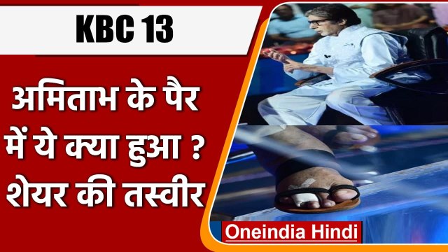 KBC 13: अमिताभ बच्चन के पैर की उंगली में फ्रैक्चर, फिर भी पूरी की शूटिंग | वनइंडिया हिंदी
