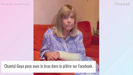 "Je me suis étalée" : Amochée, Chantal Goya s'explique sur sa mésaventure dans la rue