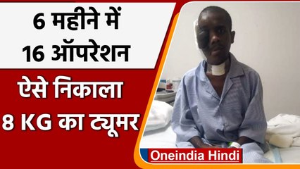 Bengalure: 16 सर्जरी के बाद Manbodh Bagh के चेहरे से ऐसे निकाला Tumour | वनइंडिया हिंदी