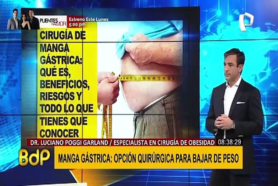 Baje de peso con la manga gástrica: conozca los beneficios de esta operación