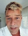 ¿Qué se hizo Ricky Martin en el rostro? El artista lo explica en este video