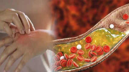 Cholesterol के बढ़ने से Body में होते है ऐसे Changes, गंभीर बीमारियों का बढ़ता है खतरा । Boldsky