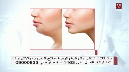 شكل الرقبة مؤشر للإصابة بعدة أمراض ..د. عاصم فرج يوضح