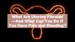 What Are Uterine Fibroids—And What Can You Do If You Have Pain and Bleeding?