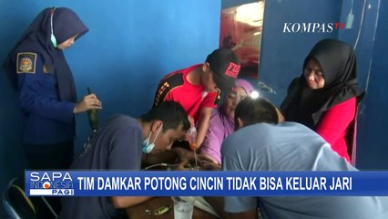 Tak Bisa Keluar dari Jari, Cincin Ibu Ini Dipotong oleh Tim Damkar