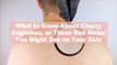What to Know About Cherry Angiomas, or Those Red Moles You Might See on Your Skin