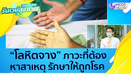 (คลิปเต็ม) "โลหิตจาง" ภาวะที่ต้องหาสาเหตุ รักษาให้ถูกโรค : Healthy Day รันเวย์สุขภาพ (ุ6 ต.ค.64)