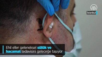 Ehil eller geleneksel sülük ve hacamat tedavisini geleceğe taşıyor