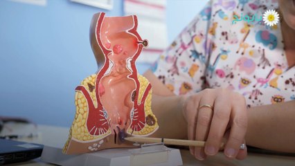 طرق وفوائد تنظيف المستقيم  وتنظيف المستقيم بالماء