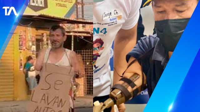 Cristian Cedeño recibió sus dos prótesis, ejemplo de lucha