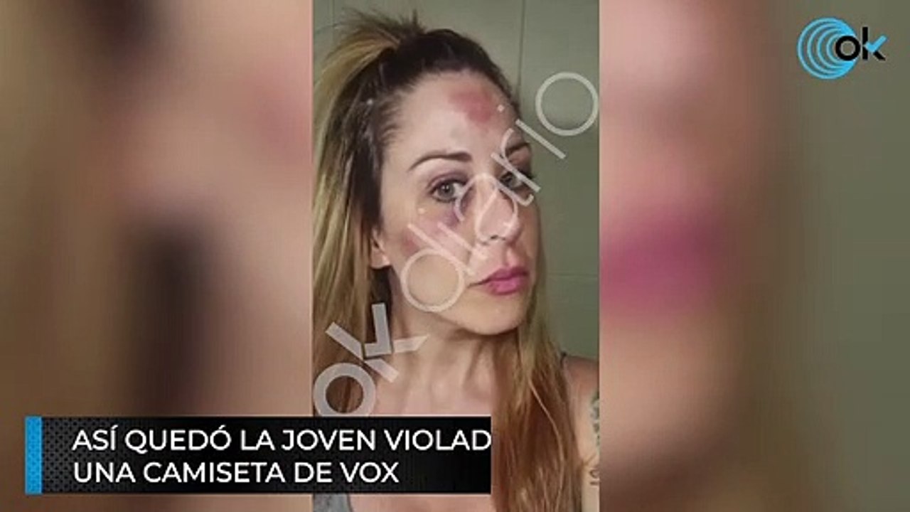 Así quedó la joven violada por tres magrebíes en Reus por llevar una camiseta de Vox