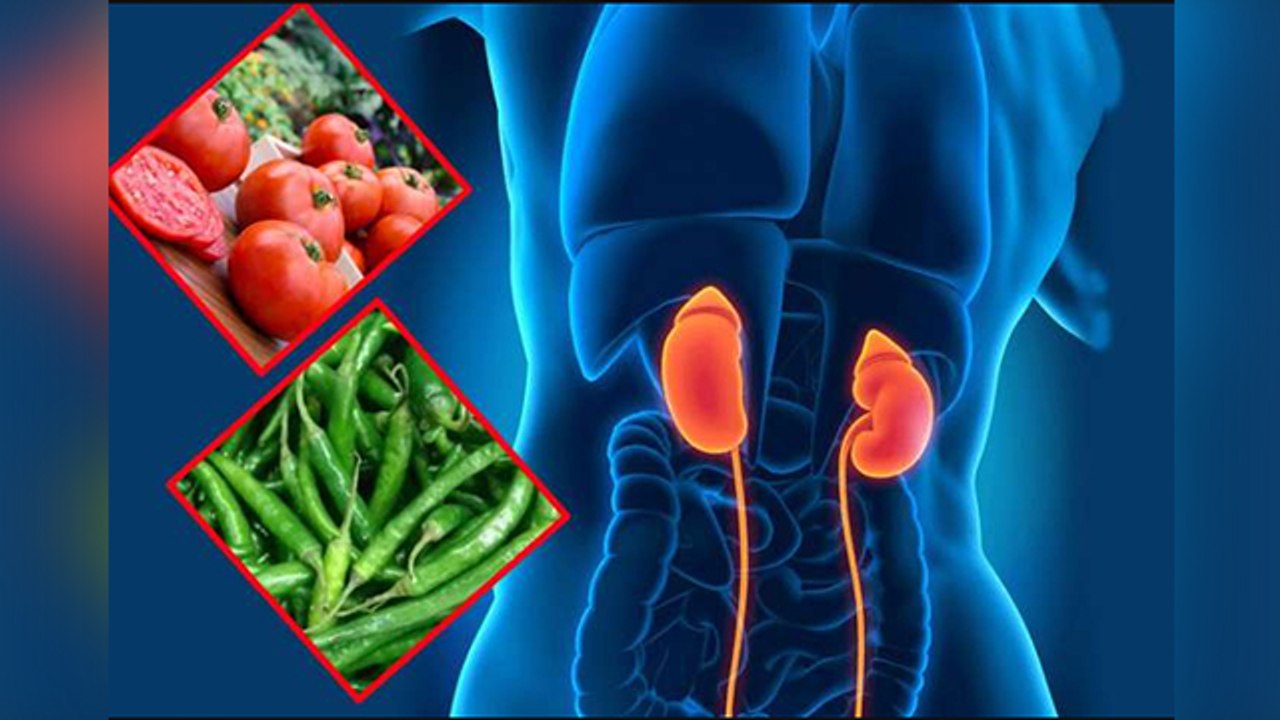 Kidney Stone होने पर क्या खाना चाहिए क्या नहीं ? Kidney Stone Par Kya