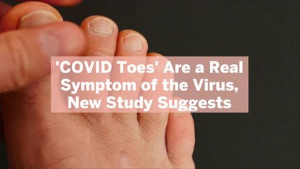 'COVID Toes' Are a Real Symptom of the Virus, New Study Suggests. Here's What to Know and What They Look Like