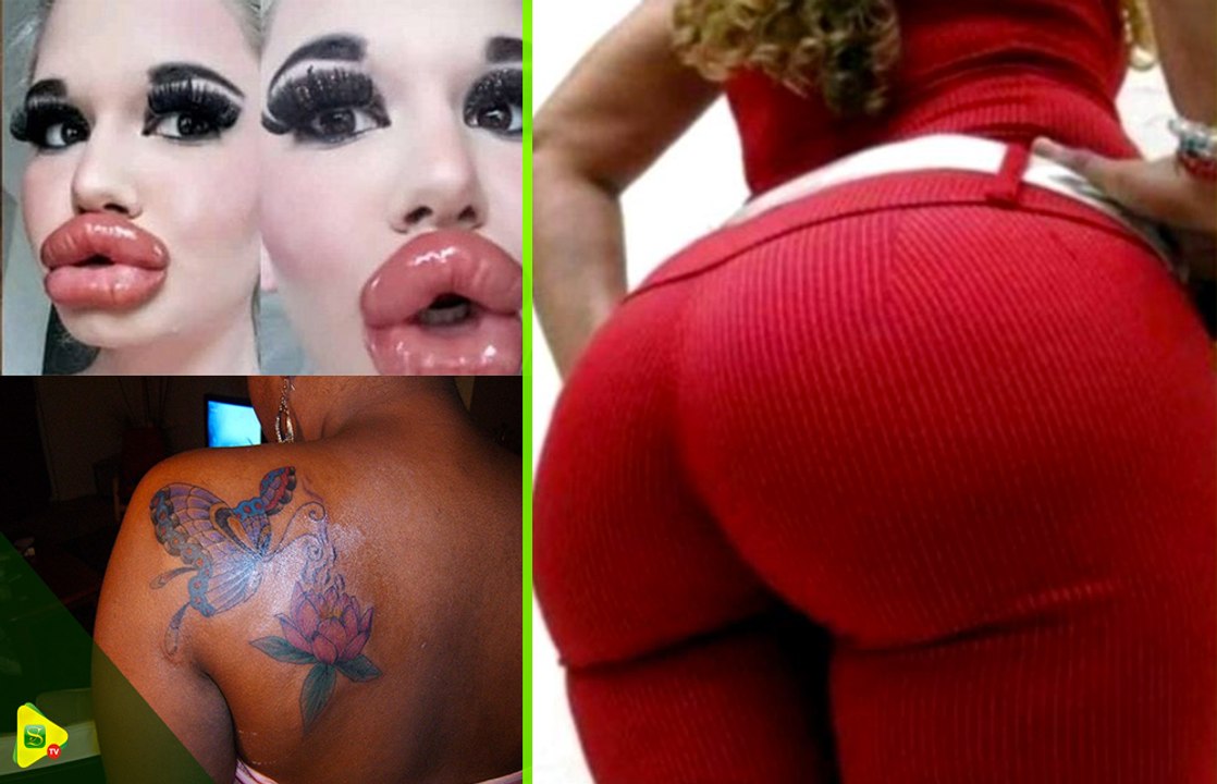 Augmentation de fesses, seins et lèvres : L'avis du public sur cette nouvelle tendance