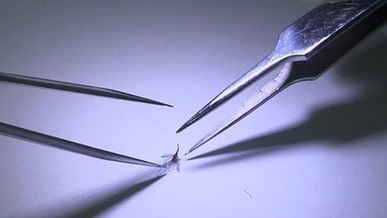 الملاريا.. مرض فتاك يقتل سنويا نحو نصف مليون شخص