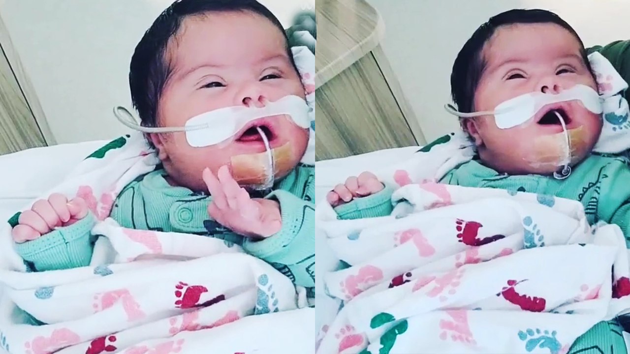 '1.5 Weeks Old baby with down syndrome interacts with family members via video'
