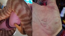 'Aussie woman demonstrates how one should proceed if their pet snake bites them'