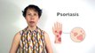 Best Psoriasis Treatment in Just 5 Days - TCM & Acupuncture for Skin Problems | GinSen