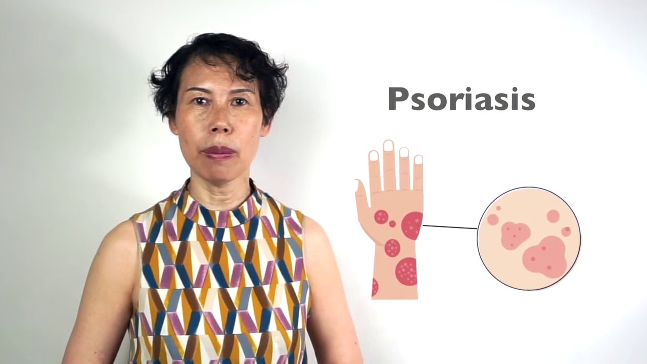 Best Psoriasis Treatment in Just 5 Days - TCM & Acupuncture for Skin Problems | GinSen