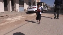 Suriyeli Muhammed protez bacakla hayata tutunacak