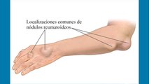 bd-como-tratar-dolor-de-codo-081021