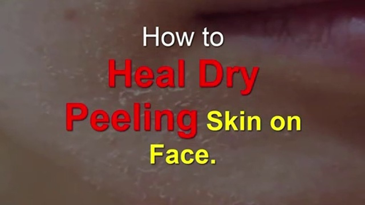 How to Heal Dry Peeling Skin on Face.