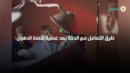 الحكة والتنميل واحتباس السوائل بعد عملية شفط الدهون