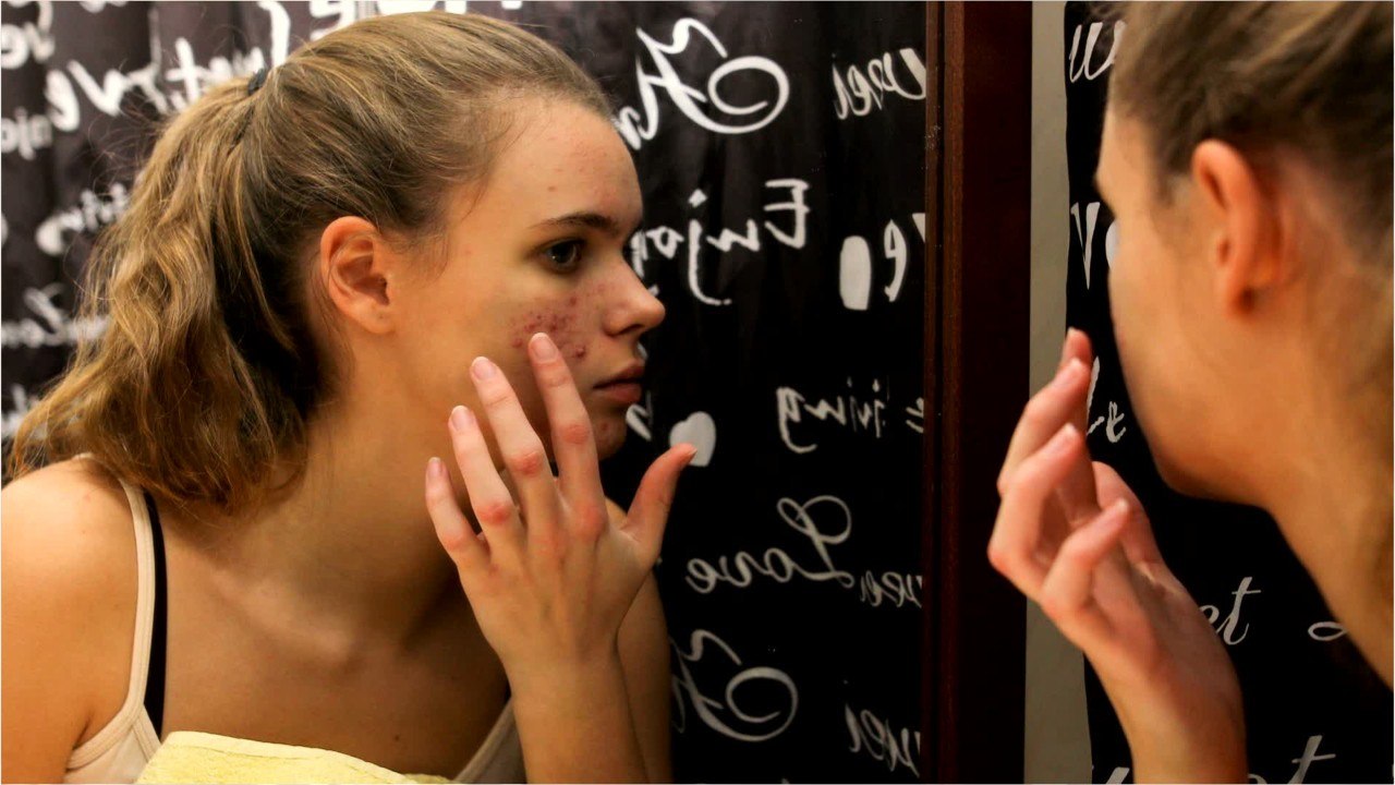 8 Amazing Home Remedies to get rid of Dark Spots video Dailymotion