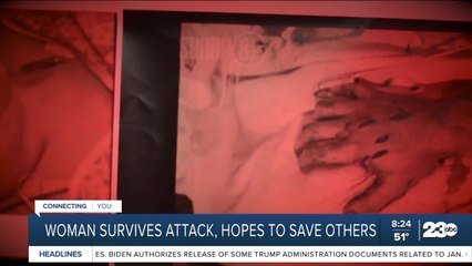 Woman survives attack, hopes to save others
