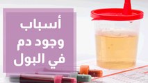 دم في البول الأسباب والأعراض والعلاج