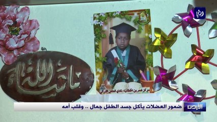 ضمور العضلات يأكل جسد الطفل جمال .. وقلب أمه