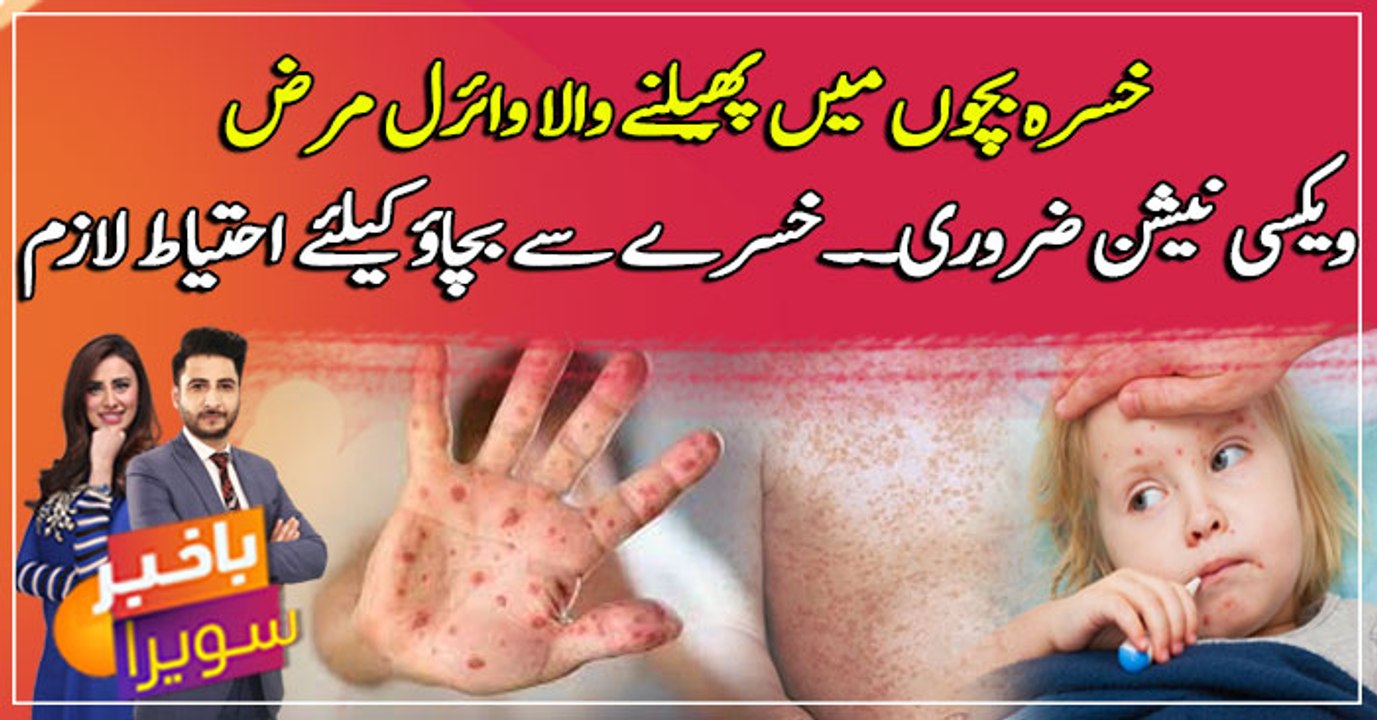 Measles: Symptoms, Diagnosis, and Treatments ... watch video