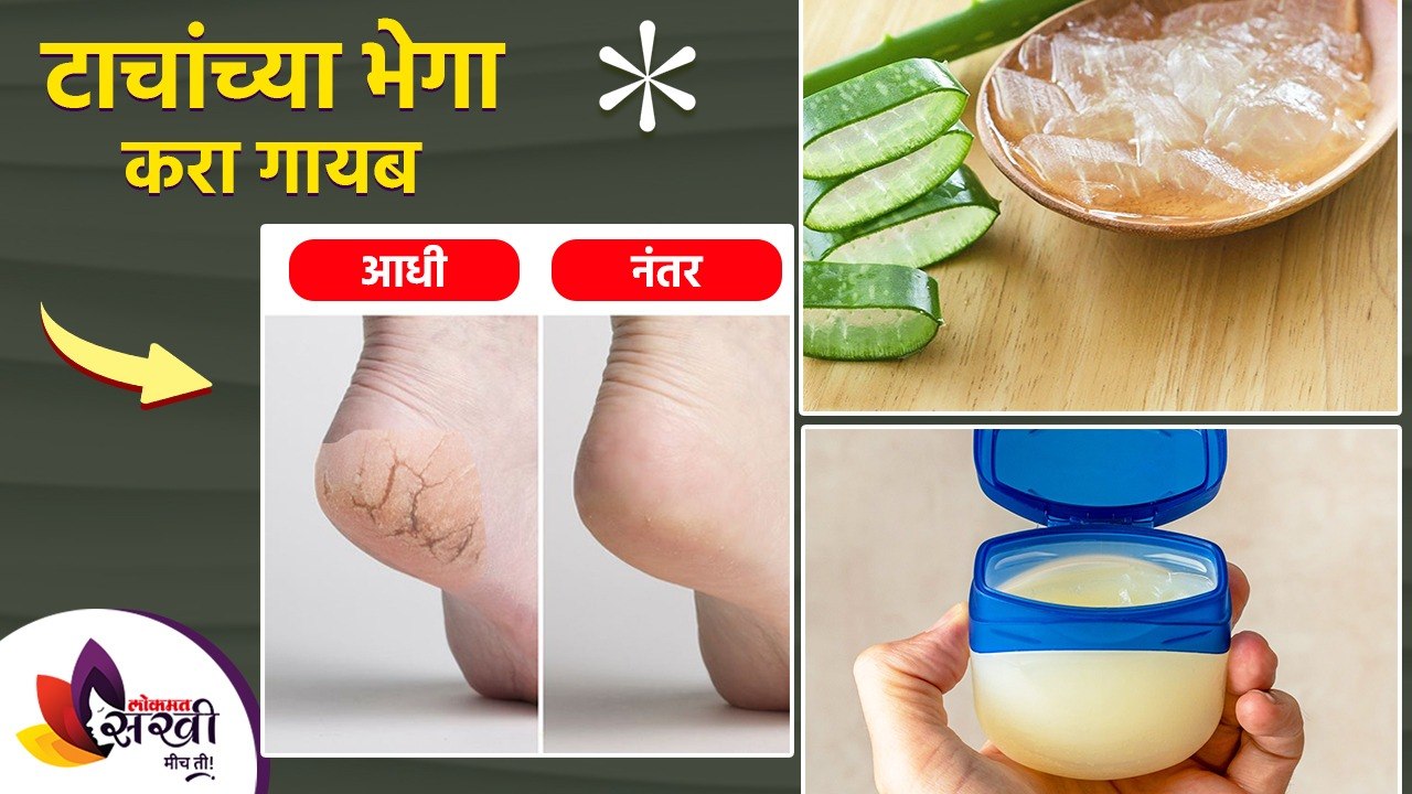 भेगा पडलेल्या टाचांपासून मिळवा सुटका करा हा घरगुती उपाय  How to Get Rid of Cracked Heels Permanently