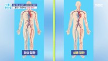 [HEALTHY] Missing blood vessels, life-threatening?, 기분 좋은 날 211013