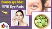 डोळ्यांची सूज कमी करण्यासाठी सोपा घरगुती उपाय । How to Reduce Eye Swelling | Lokmat Sakhi