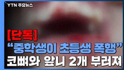 [단독] 남자 중학생이 여자 초등생 폭행..."코뼈와 앞니 부러지고 정신과 치료" / YTN